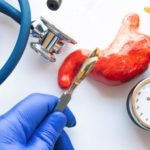 what is bariatric surgery?